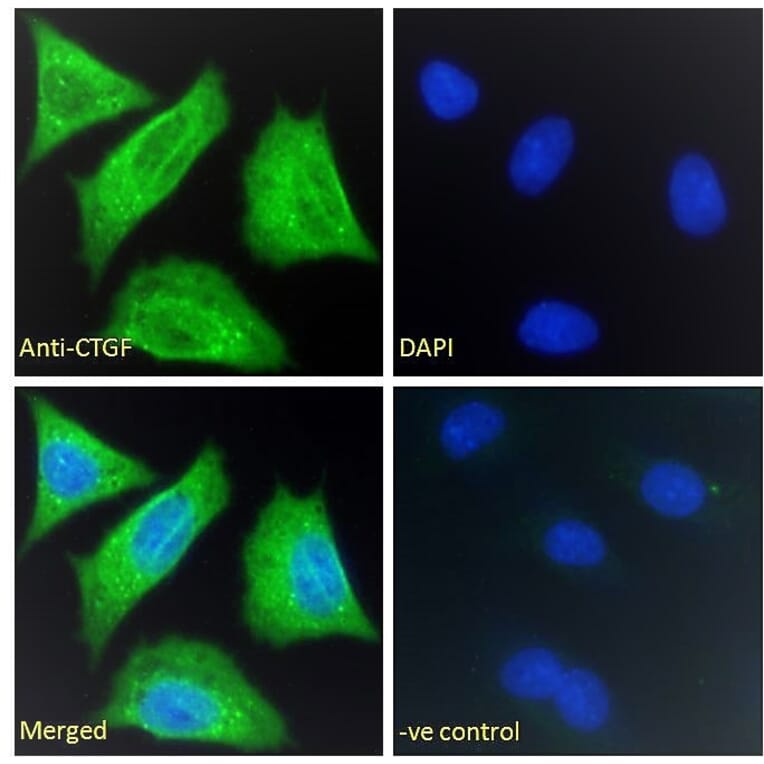 Immunofluorescence - Anti-CTGF Antibody (A286078) - Antibodies.com