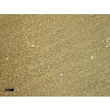 Immunohistochemistry - Anti-CTGF Antibody (A286078) - Antibodies.com