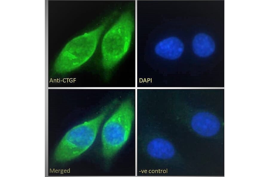 Immunofluorescence - Anti-CTGF Antibody (A286079) - Antibodies.com