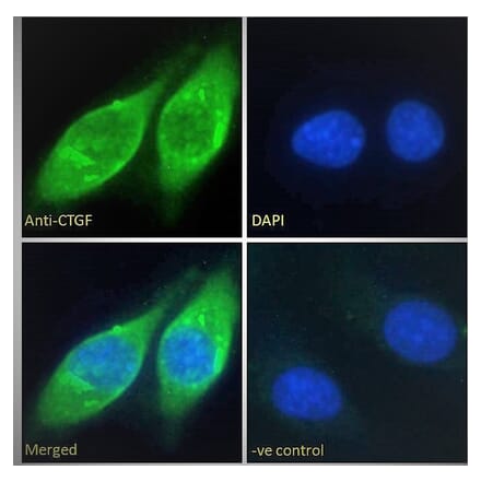 Immunofluorescence - Anti-CTGF Antibody (A286079) - Antibodies.com
