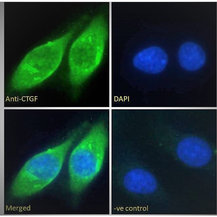 Immunofluorescence - Anti-CTGF Antibody (A286079) - Antibodies.com
