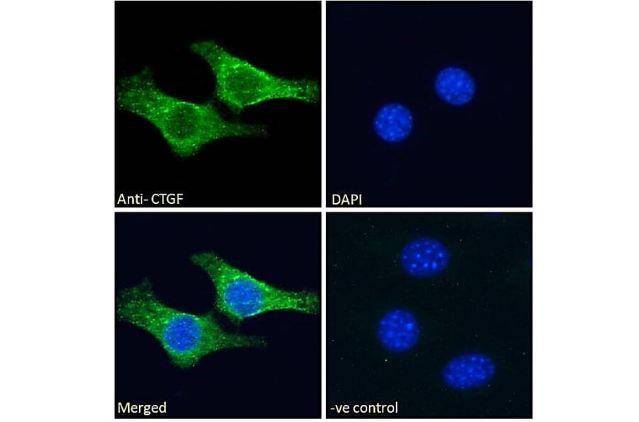 Immunofluorescence - Anti-CTGF Antibody (A286079) - Antibodies.com