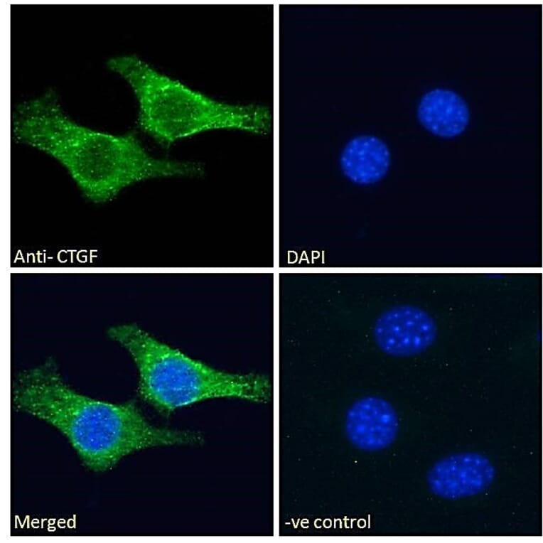 Immunofluorescence - Anti-CTGF Antibody (A286079) - Antibodies.com