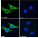 Immunofluorescence - Anti-CTGF Antibody (A286079) - Antibodies.com