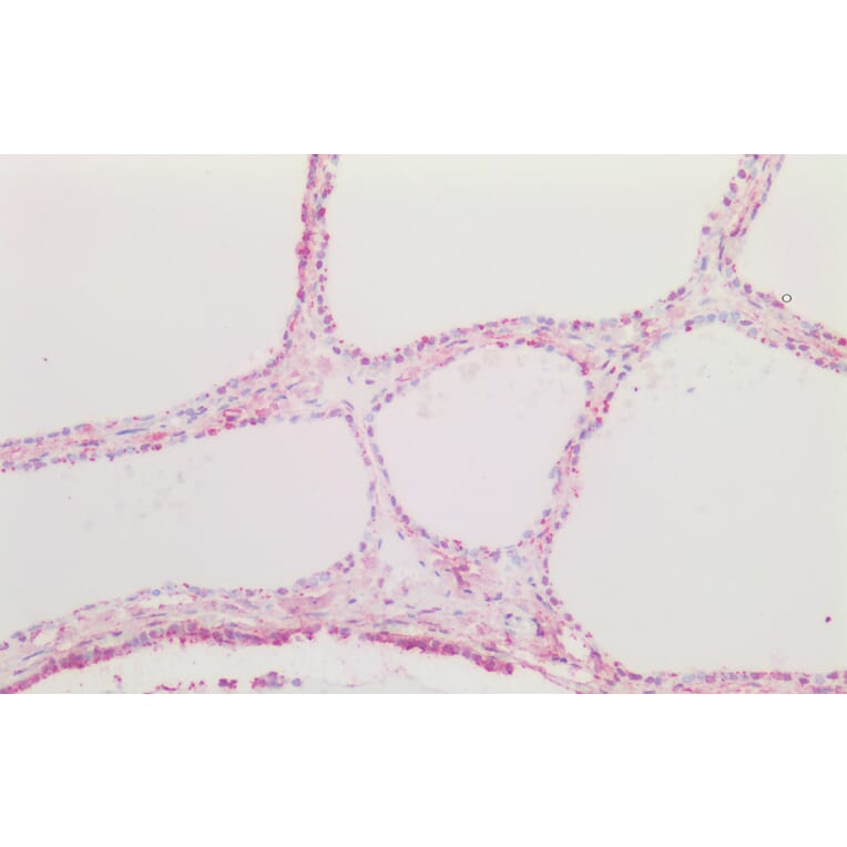 Immunohistochemistry - Anti-CTGF Antibody (A286079) - Antibodies.com