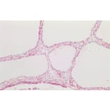 Immunohistochemistry - Anti-CTGF Antibody (A286079) - Antibodies.com