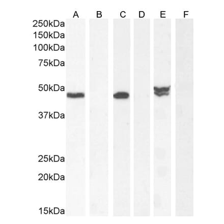 Western Blot - Anti-NAT8L Antibody (A286080) - Antibodies.com