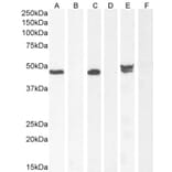 Western Blot - Anti-NAT8L Antibody (A286080) - Antibodies.com