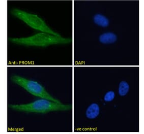 Immunofluorescence - Anti-CD133 Antibody (A286082) - Antibodies.com