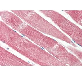 Immunohistochemistry - Anti-THNSL2 Antibody (A286083) - Antibodies.com