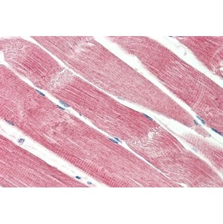 Immunohistochemistry - Anti-THNSL2 Antibody (A286083) - Antibodies.com