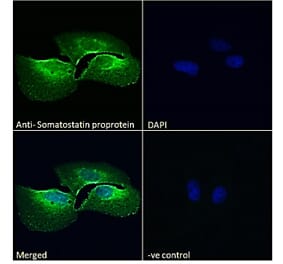 Immunofluorescence - Anti-Somatostatin Antibody (A286084) - Antibodies.com