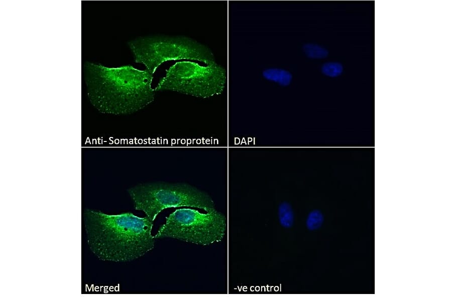 Immunofluorescence - Anti-Somatostatin Antibody (A286084) - Antibodies.com