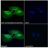 Immunofluorescence - Anti-Somatostatin Antibody (A286084) - Antibodies.com