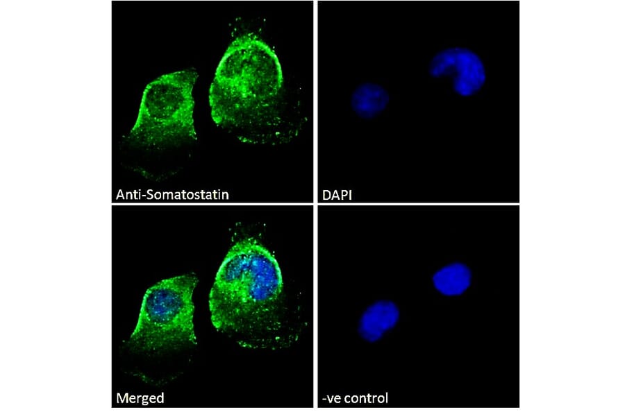Immunofluorescence - Anti-Somatostatin Antibody (A286084) - Antibodies.com