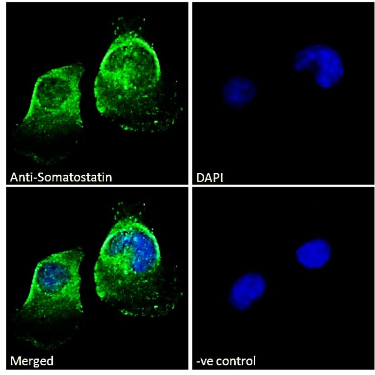 Immunofluorescence - Anti-Somatostatin Antibody (A286084) - Antibodies.com