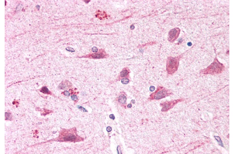 Immunohistochemistry - Anti-BOD1L Antibody (A286085) - Antibodies.com
