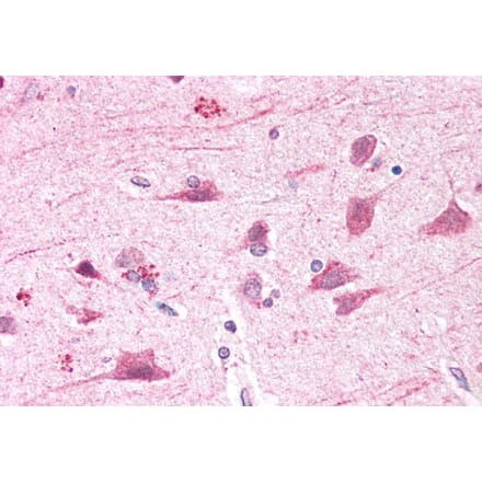Immunohistochemistry - Anti-BOD1L Antibody (A286085) - Antibodies.com