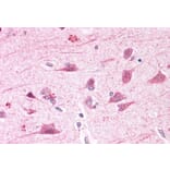 Immunohistochemistry - Anti-BOD1L Antibody (A286085) - Antibodies.com