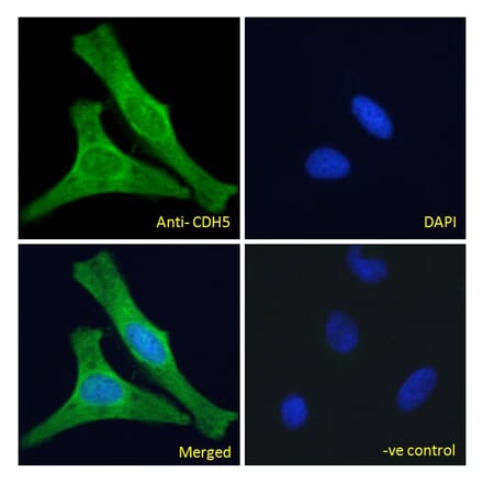 Immunofluorescence - Anti-VE Cadherin Antibody (A286091) - Antibodies.com