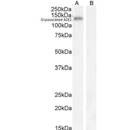 Western Blot - Anti-ACE2 Antibody (A286092) - Antibodies.com