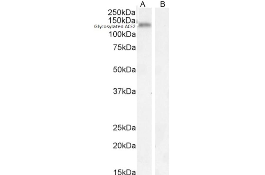 Western Blot - Anti-ACE2 Antibody (A286092) - Antibodies.com