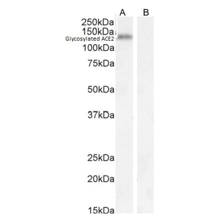 Western Blot - Anti-ACE2 Antibody (A286092) - Antibodies.com