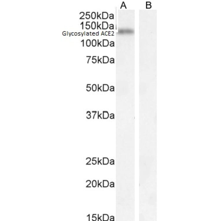 Western Blot - Anti-ACE2 Antibody (A286092) - Antibodies.com