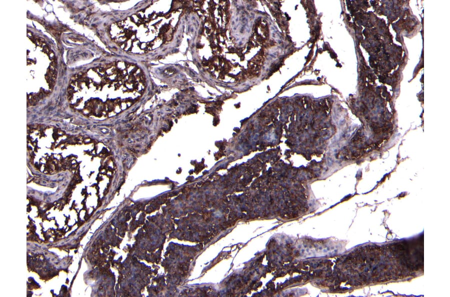 Immunohistochemistry - Anti-ACE2 Antibody (A286092) - Antibodies.com