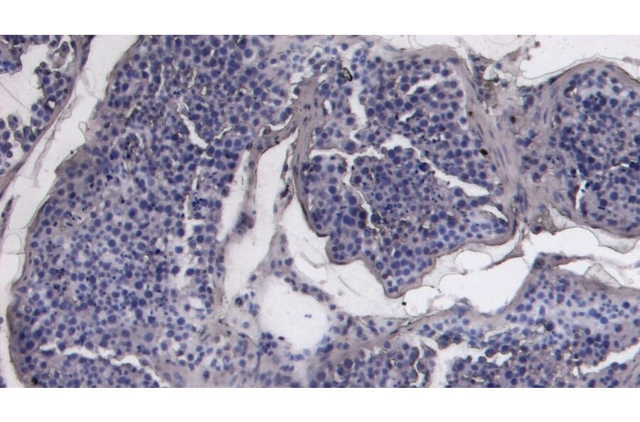 Immunohistochemistry - Anti-ACE2 Antibody (A286092) - Antibodies.com