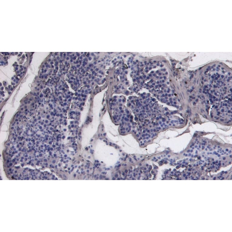 Immunohistochemistry - Anti-ACE2 Antibody (A286092) - Antibodies.com