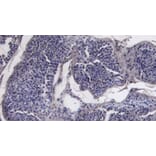 Immunohistochemistry - Anti-ACE2 Antibody (A286092) - Antibodies.com