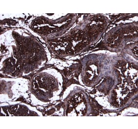 Immunohistochemistry - Anti-ACE2 Antibody (A286094) - Antibodies.com