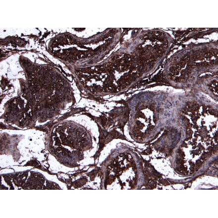 Immunohistochemistry - Anti-ACE2 Antibody (A286094) - Antibodies.com