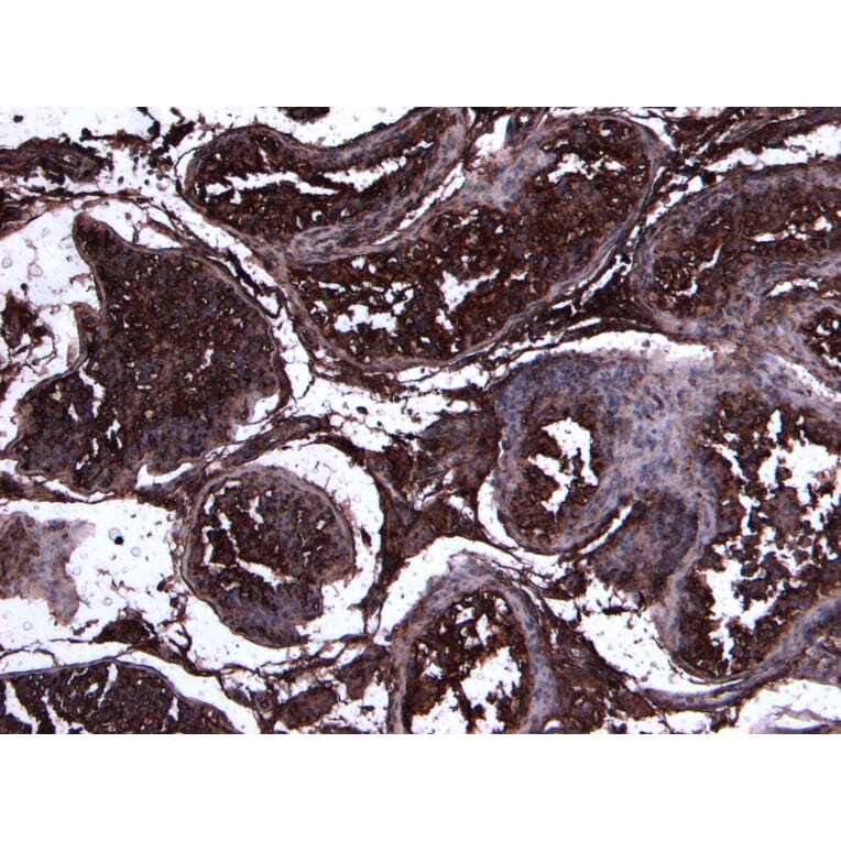 Immunohistochemistry - Anti-ACE2 Antibody (A286094) - Antibodies.com
