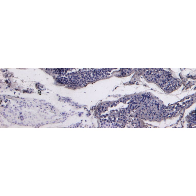 Immunohistochemistry - Anti-ACE2 Antibody (A286094) - Antibodies.com