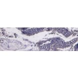 Immunohistochemistry - Anti-ACE2 Antibody (A286094) - Antibodies.com