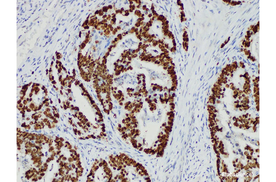 Validation Data - Anti-p53 Antibody [YN01765m] (A288701)