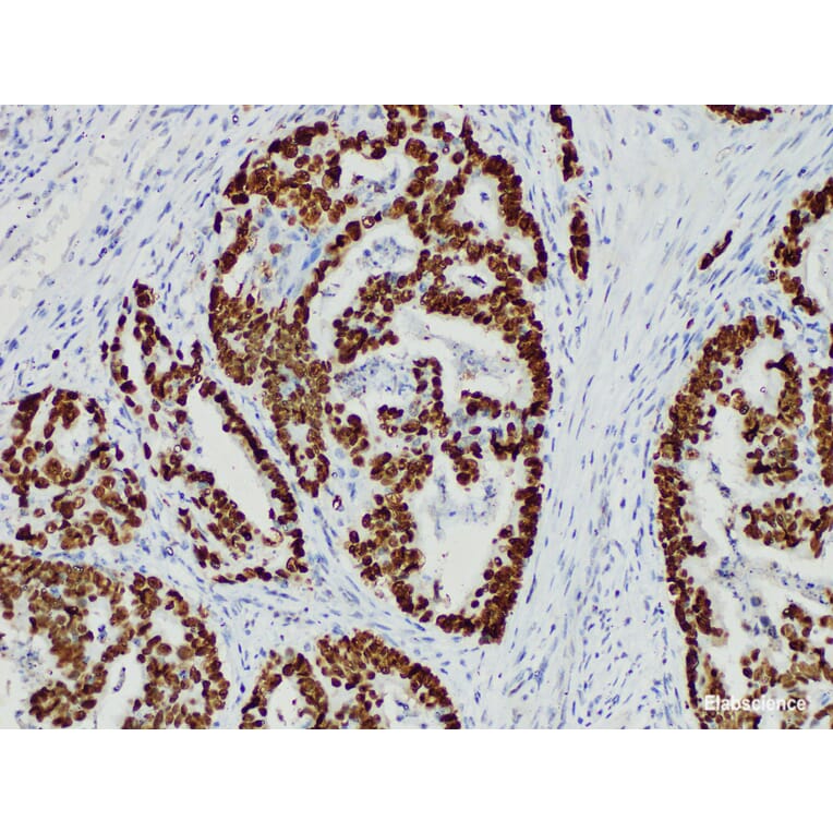 Validation Data - Anti-p53 Antibody [YN01765m] (A288701)