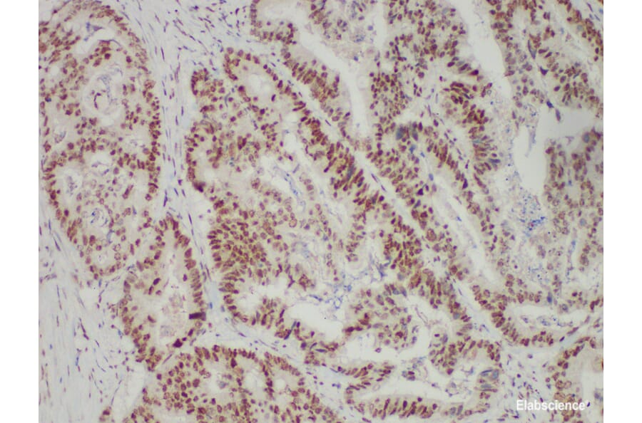 Validation Data - Anti-PMS2 Antibody [YN01825r] (A288706)