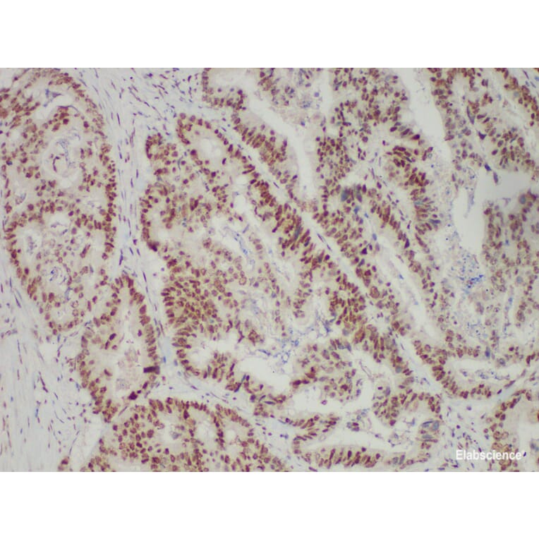 Validation Data - Anti-PMS2 Antibody [YN01825r] (A288706)