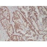 Validation Data - Anti-PMS2 Antibody [YN01825r] (A288706)