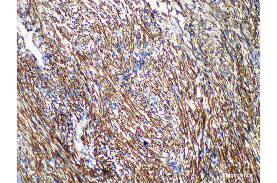 Validation Data - Anti-Caldesmon Antibody [YN00146m] (A288707)