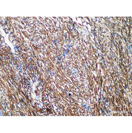 Validation Data - Anti-Caldesmon Antibody [YN00146m] (A288707)