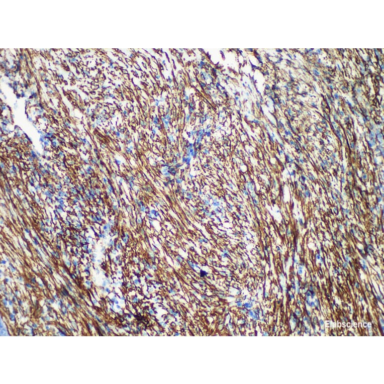Validation Data - Anti-Caldesmon Antibody [YN00146m] (A288707)