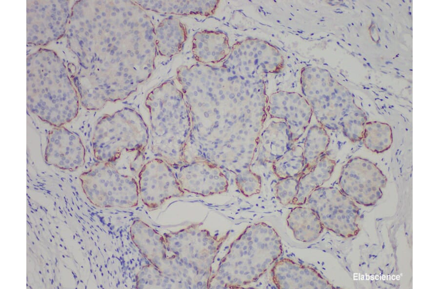 Validation Data - Anti-Calponin Antibody [YN00156m] (A288708)