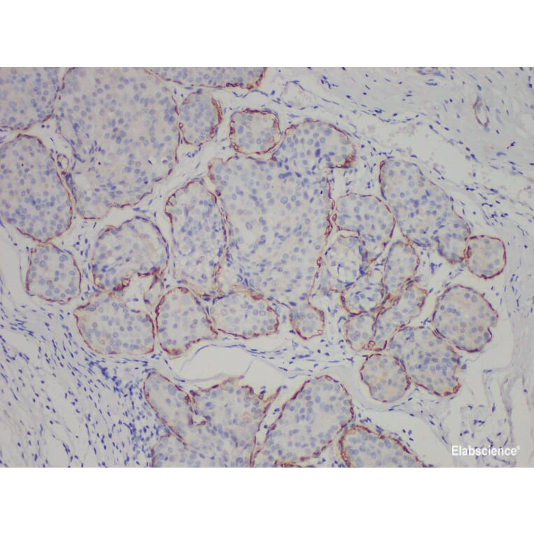 Validation Data - Anti-Calponin Antibody [YN00156m] (A288708)