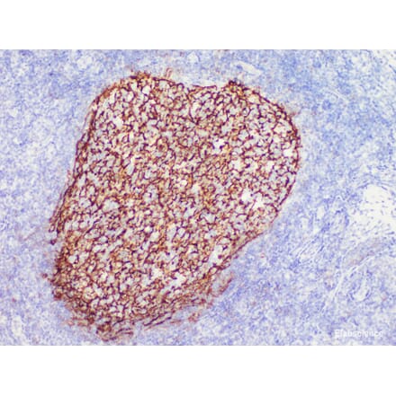 Validation Data - Anti-CD21 Antibody [YN00285m] (A288709)