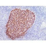 Validation Data - Anti-CD21 Antibody [YN00285m] (A288709)