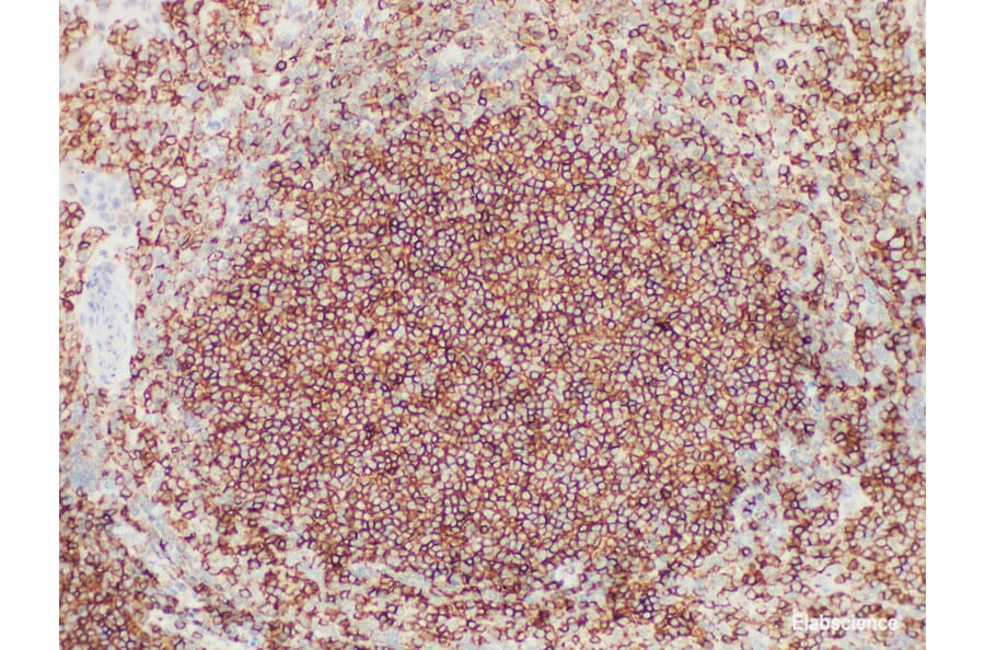 Validation Data - Anti-CD45 (LCA) Antibody [YN00375m] (A288711)